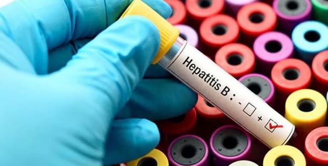 Her 30 Saniyede Bir kişi Hepatite Bağlı Hastalıklara Yeniliyor