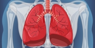 Aniden gelişen tek taraflı göğüs ağrısına dikkat!